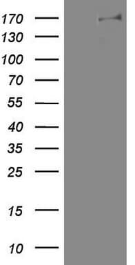 DOT1L / DOT1 Antibody (aa1-434, clone OTI1D8)