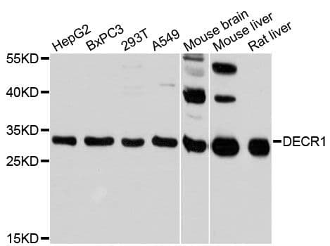 Polyclonal Rabbit anti-Human DECR1 Antibody (WB)