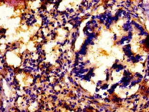 MNK / ATP7A Antibody