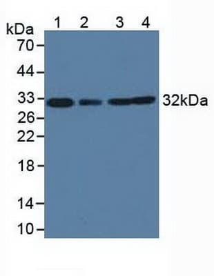 GC1qR / C1QBP Antibody (aa71-278)