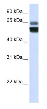 SMPD1 / Acid Sphingomyelinase Antibody (aa396-445)