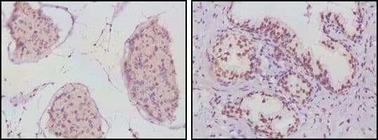 AR / Androgen Receptor Antibody (clone 2H8)