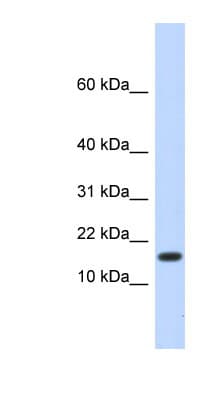 HERC4 Antibody (N-Terminus)