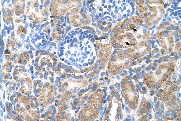SGPP2 Antibody (aa301-350)