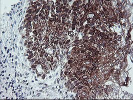CAST / Calpastatin Antibody (clone OTI1E7)