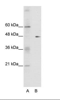 Polyclonal Rabbit anti-Human GDI2 Antibody (aa361-410, IHC, WB)