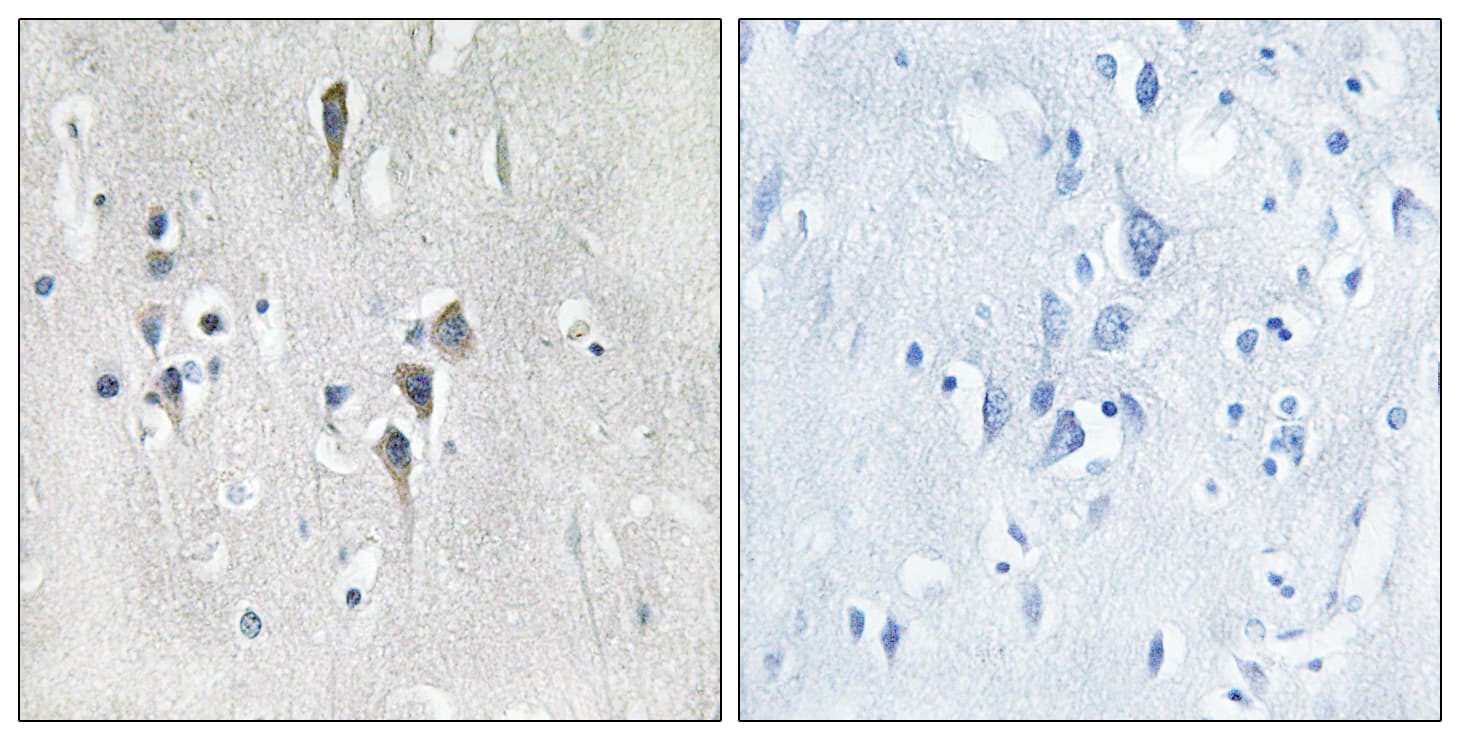 CaMKII Alpha+Delta Antibody (Internal)