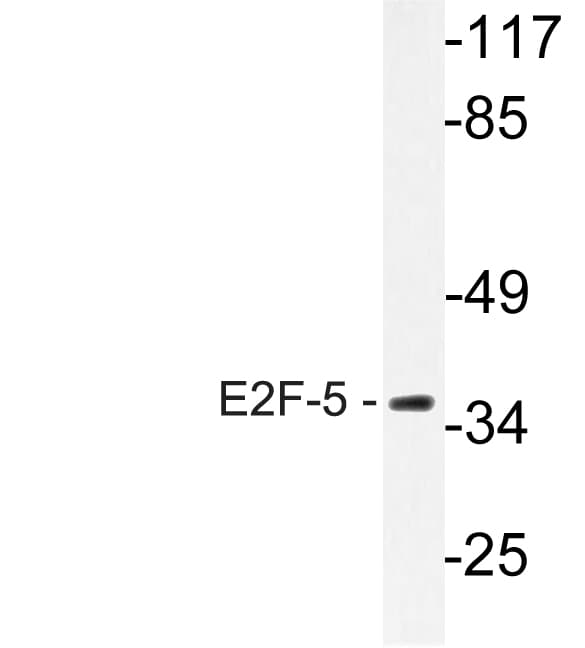 IHC-plus™ E2F5 Antibody (aa93-142)