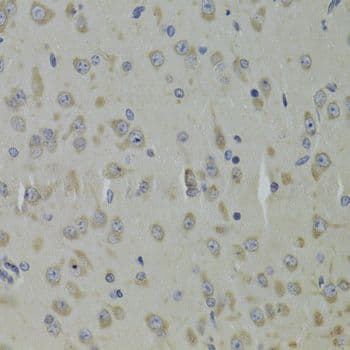 Polyclonal Rabbit anti-Human RPL9 / Ribosomal Protein L9 Antibody (IHC, IF, WB)