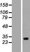 NAT15 Protein (Over-Expression Lysate Myc-DDK (Flag))