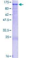 Human HRS / HGS Protein (Recombinant GST)