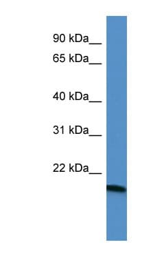 APG12 / ATG12 Antibody (aa79-128)