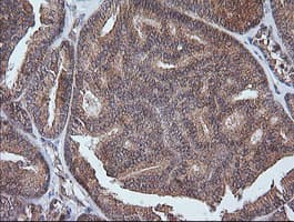 ETS2 Antibody (aa90-349, clone OTI2A3, Carrier-free)