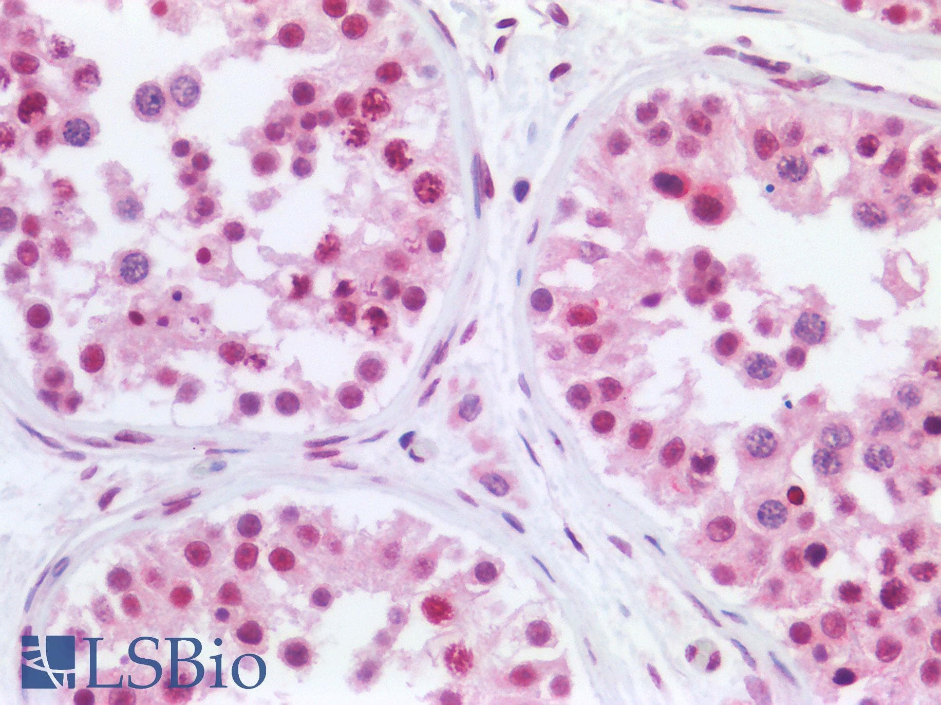 PathPlus™ p84 / THOC1 Antibody (aa15-374, clone 5E10)