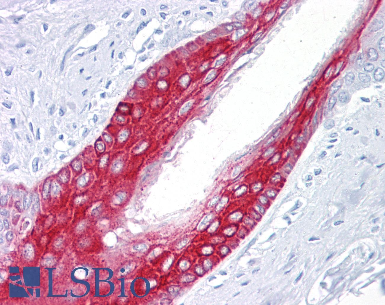 PathPlus™ KRT17 / CK17 / Cytokeratin 17 Antibody (clone E3)