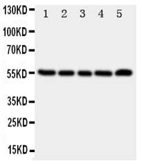 Polyclonal Rabbit anti-Human TACR1 / NK1R Antibody (aa231-245, WB)
