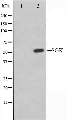 SGK1 / SGK Antibody