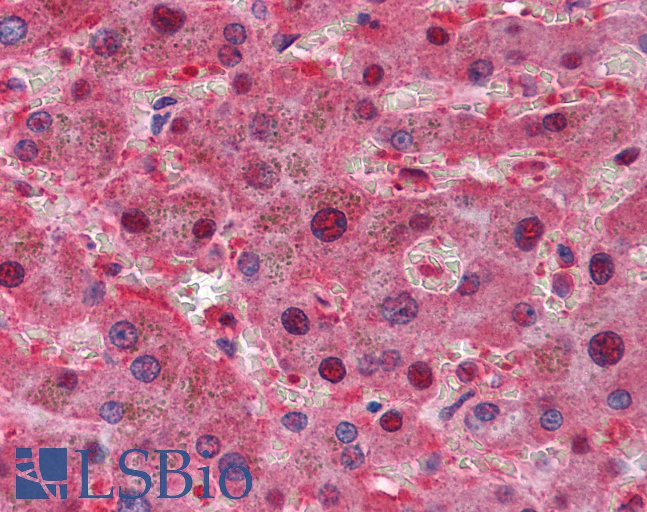 IHC-plus™ Monoclonal Mouse anti-Human LPA / Lipoprotein a Antibody (clone 8F6A9, IHC, WB)