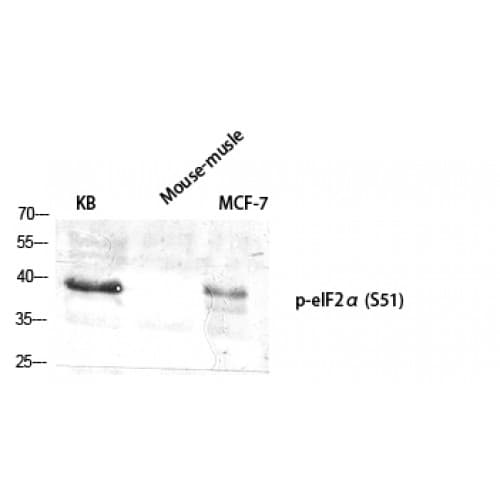 Polyclonal Rabbit anti-Human EIF2S1 Antibody (pS51, IHC, WB)