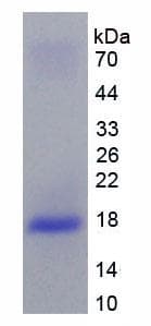 Human IL10RB Protein (Recombinant His, N-Terminal)