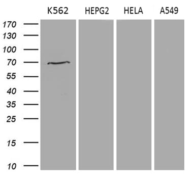 Monoclonal Mouse anti-Human PRMT5 Antibody (clone OTI3E6, aa238-499, WB)