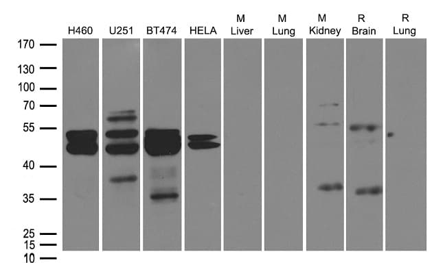 DUSP1 / MKP1 Antibody