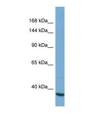 Polyclonal Rabbit anti-Human SARDH Antibody (aa198-247, WB)