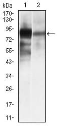 IHC-plus™ ALPL / Alkaline Phosphatase Antibody (aa18-502, clone 2F4)