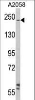 LAMB2 / Laminin Beta 2 Antibody (aa1579-1606)