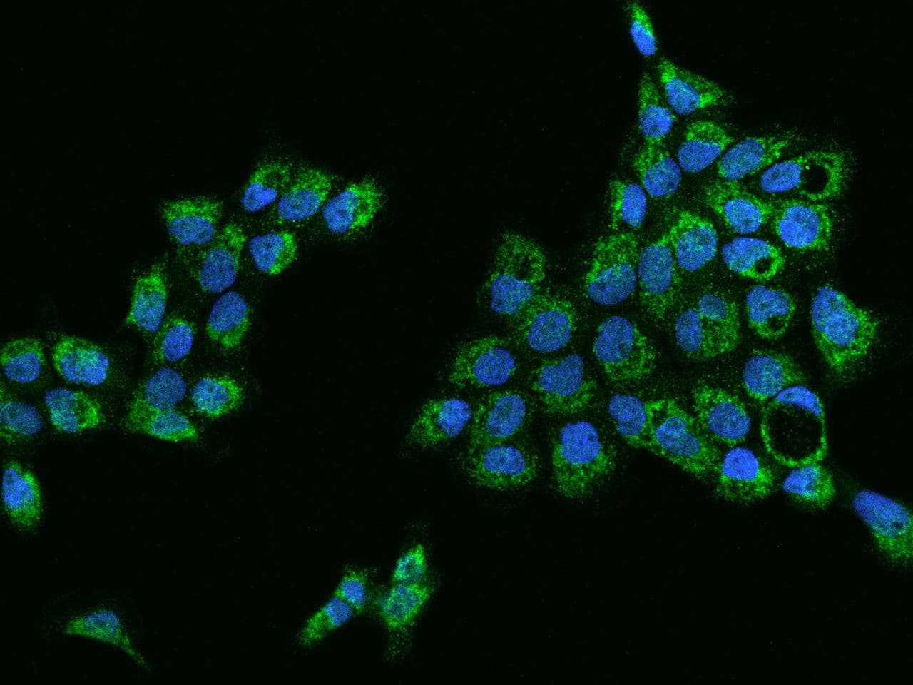 KLHL25 Antibody