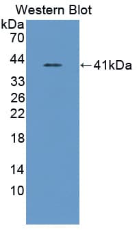ASNS Antibody (aa213-536)