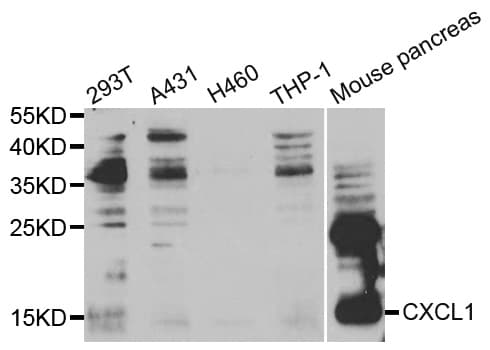 Polyclonal Rabbit anti-Human CXCL1 / GRO Alpha Antibody (IHC, WB)