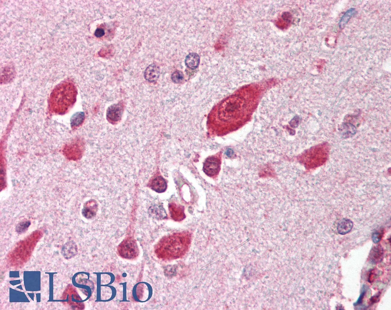 IHC-plus™ Polyclonal Rabbit anti-Human DDB1 Antibody (aa198-213, IHC, WB)