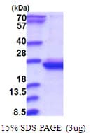 Human RWDD4A / RWDD4 Protein (Recombinant His)
