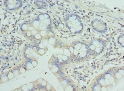 ZNF193 Antibody