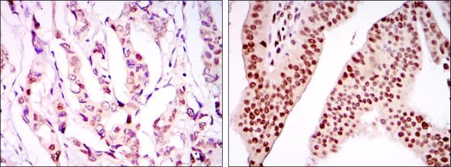 PSIP1 / LEDGF Antibody (clone 60000)