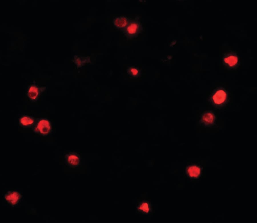 IHC-plus™ PIBF1 / PIBF Antibody