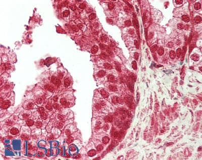 IHC-plus™ PBRM1 / BAF180 / PB1 Antibody (aa1639-1689)