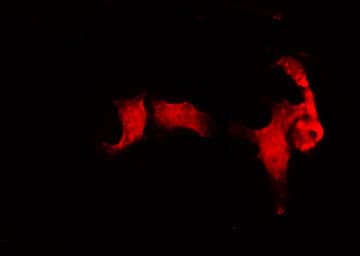 Polyclonal Rabbit anti-Human APC6 / CDC16 Antibody (IF, WB)