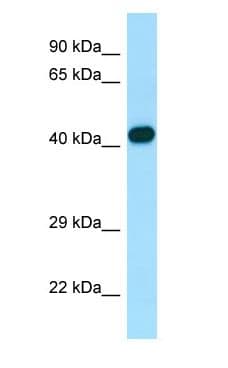 ARPC1B / p41-ARC / ARP2 Antibody (aa299-348)