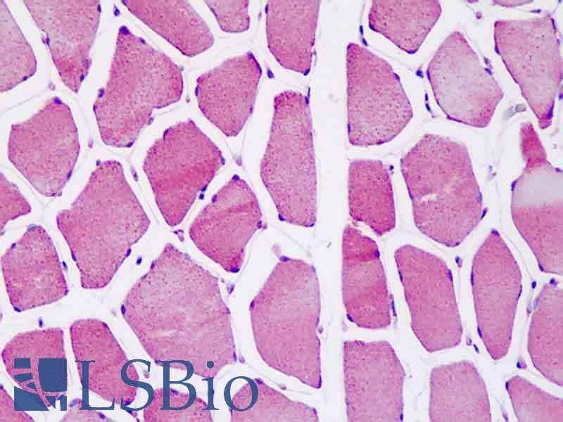 IHC-plus™ ATP5O Antibody (aa38-64)