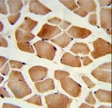 AMPD2 Antibody (aa187-217)