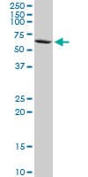 PPP2R5D Antibody (clone 1A3)