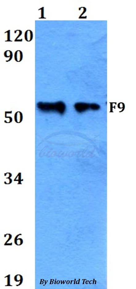 F9 / Factor IX Antibody
