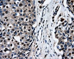 RIP1 / RALBP1 Antibody (clone OTI6C6)