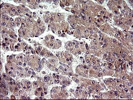 Monoclonal Mouse anti-Human PLA2G16 / HRASLS3 Antibody (clone OTI1A5, IHC, IF, WB)