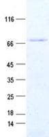 Human ZNHIT6 / C1orf181 Protein (Recombinant His, N-Terminal)