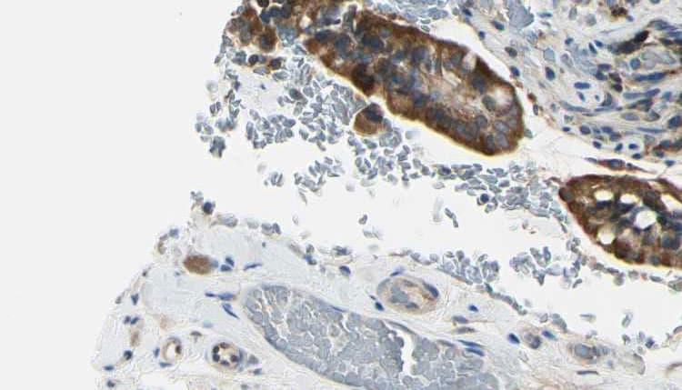 ACVRL1 Antibody