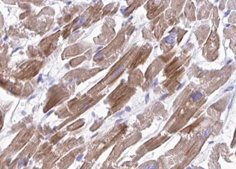 Polyclonal Rabbit anti-Human CDH13 / Cadherin 13 Antibody (IHC, WB)