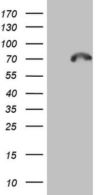 CAPN5 / Calpain 5 Antibody (aa274-578, clone OTI4E11)